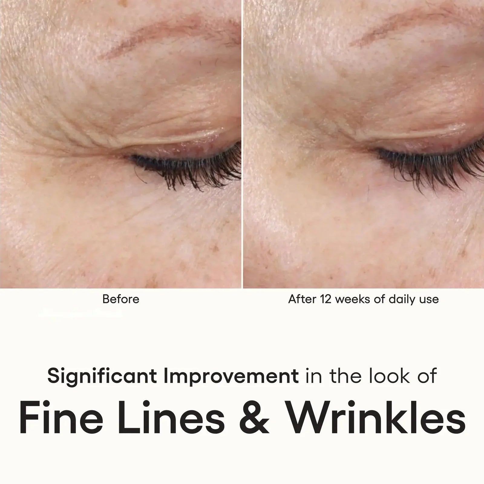 INTENSE serum