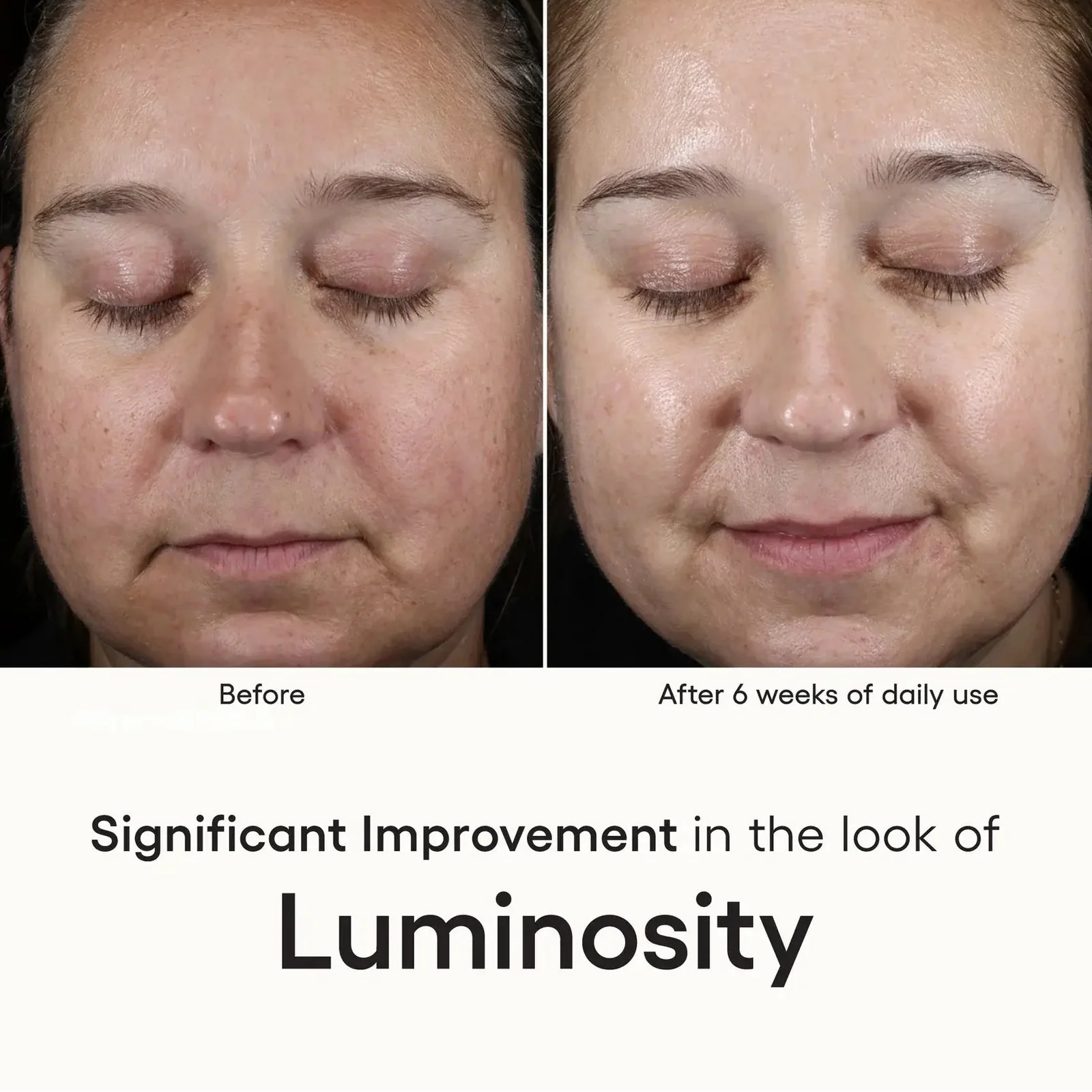INTENSE serum